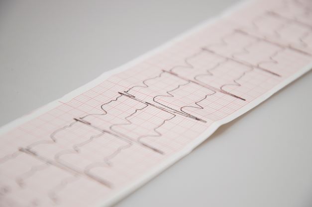 Heartbeart Small (2)